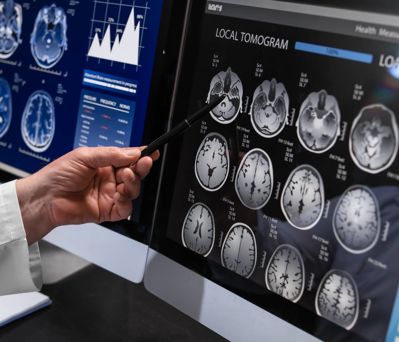 Neurologia, uma das especialidades na Andar Clinic